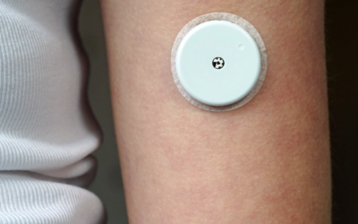 SHOULD YOU WEAR A CONTINUOUS GLUCOSE MONITOR?