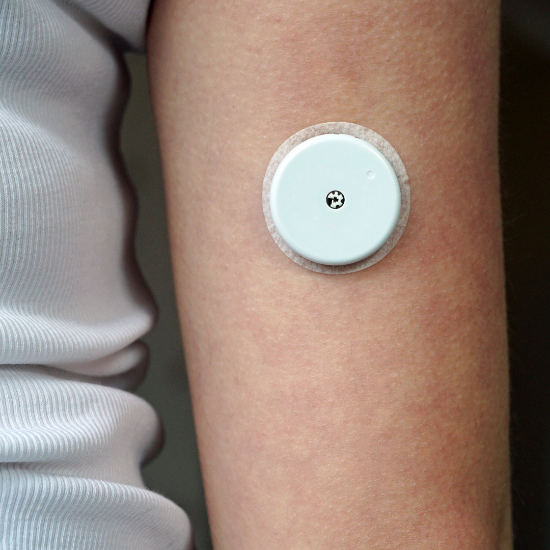 continuous glucose monitor on arm, should you wear a CGM?